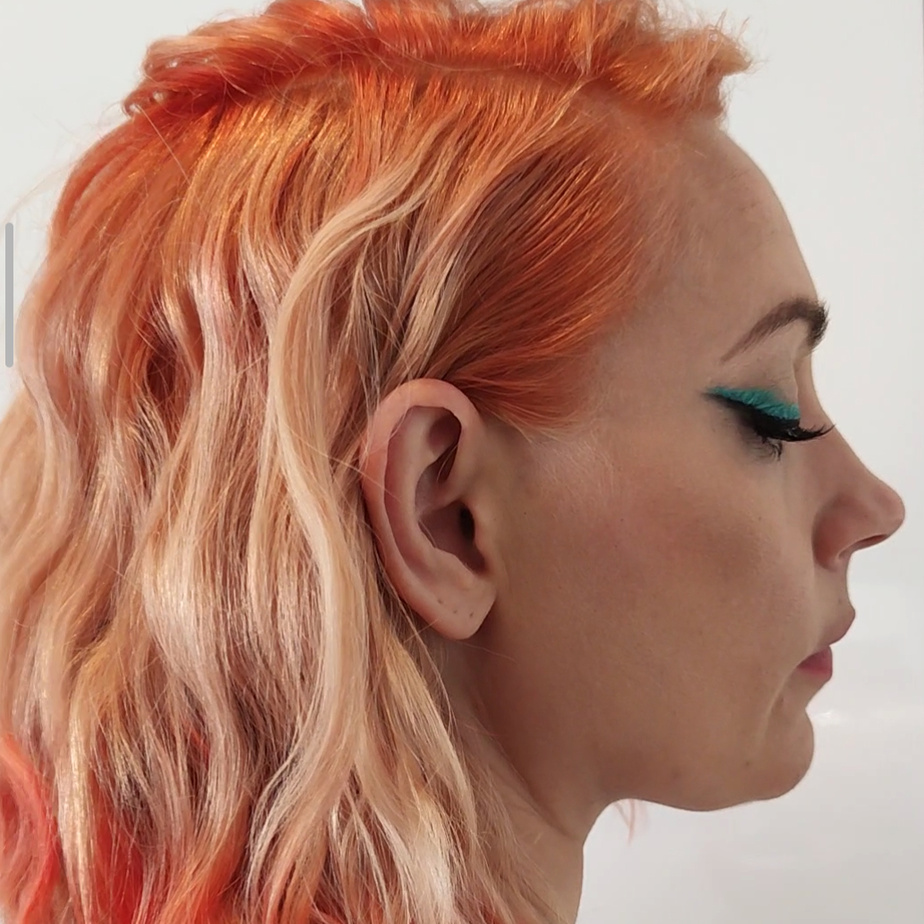 Sonja